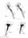 Fig. 02 - Separable lubrication