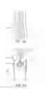 Fig. 05 - Hairdressing scissors