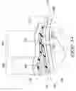 Fig. 12 - Force distributing interface system