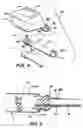 Fig. 04 - Apparatus for collecting lightweight packing particulates