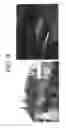 Fig. 10 - Method and apparatus for detecting damage to high-pressure tank