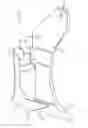 Fig. 01 - Knife opener for use with an agricultural implement