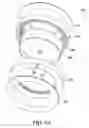 Fig. 14 - Multiple hardness non-pneumatic tire
