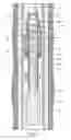 Fig. 03 - Consumable Downhole Tools
