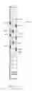 Fig. 11 - Consumable Downhole Tools