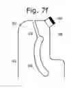 Fig. 14 - Resilient Bit Systems and Methods
