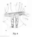 Fig. 05 - Dispensing device