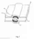 Fig. 08 - Compound differential thread systems