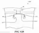 Fig. 10 - Article attachment system and device