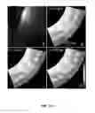 Fig. 27 - 4D imaging in an ultrafast electron microscope