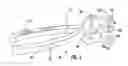 Fig. 04 - TENSIONING TOOL AND METHOD FOR USING SAME