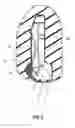 Fig. 03 - Headrest and vehicle seat provided with the same