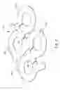 Fig. 10 - INDUCTION COIL WITHOUT A WELD
