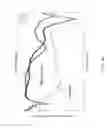 Fig. 64 - METAMATERIAL STRUCTURES WITH MULTILAYER METALLIZATION AND VIA