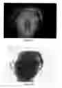 Fig. 09 - Divergence ratio distance mapping camera