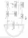 Fig. 02 - SYSTEM AND METHOD FOR PLANNING AND GUIDING PERCUTANEOUS PROCEDURES
