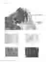Fig. 02 - KIT FOR DECIDING DEGREE OF MALIGNANCY IN PROSTATE CANCER AND METHOD OF USING THE SAME