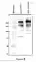 Fig. 02 - Factor VIII polymer conjugates