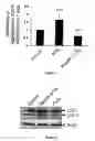 Fig. 07 - cAMP DEPENDENT INDUCTION OF AUTOPHAGY