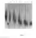 Fig. 02 - COMPLEX COMBINING AN ORGANIC SILICON DERIVATIVE WITH HYALURONIC ACID CALIBRATED FRAGMENTS, FOR PREVENTIVE AND REPAIRING ACTION OF CUTANEOUS DAMAGES