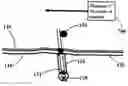 Fig. 01 - Directed current for hair removal