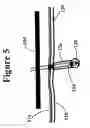 Fig. 06 - Directed current for hair removal
