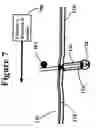 Fig. 08 - Directed current for hair removal