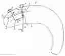 Fig. 01 - Apparatus for tissue repair