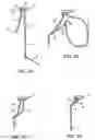 Fig. 03 - Apparatus for tissue repair