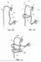 Fig. 04 - Apparatus for tissue repair
