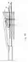 Fig. 37 - Apparatus for tissue repair