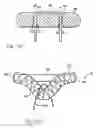 Fig. 41 - Apparatus for tissue repair