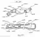 Fig. 46 - Apparatus for tissue repair