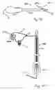 Fig. 63 - Apparatus for tissue repair