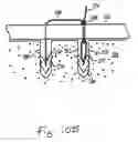 Fig. 65 - Apparatus for tissue repair