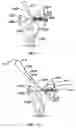 Fig. 68 - Apparatus for tissue repair
