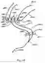 Fig. 71 - Apparatus for tissue repair
