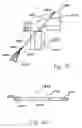 Fig. 72 - Apparatus for tissue repair