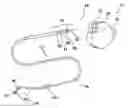 Fig. 01 - MRI compatible implantable medical lead and method of making same