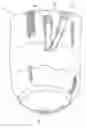 Fig. 01 - Prosthetic attachment system with low profile attachment pad