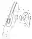 Fig. 04 - Prosthetic attachment system with low profile attachment pad