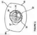 Fig. 04 - Automated edged lens deblocking system