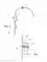 Fig. 05 - DEVICE AND METHOD FOR PRODUCING AN ORTHOPAEDIC AID, AND CORRESPONDING AIDS