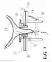 Fig. 10 - DEVICE AND METHOD FOR PRODUCING AN ORTHOPAEDIC AID, AND CORRESPONDING AIDS