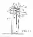 Fig. 12 - DEVICE AND METHOD FOR PRODUCING AN ORTHOPAEDIC AID, AND CORRESPONDING AIDS