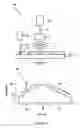 Fig. 02 - Glass bodies and methods of making
