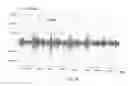 Fig. 24 - Convective accelerometer