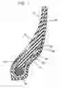 Fig. 02 - TIRE WITH COMPONENT CONTAINING POLYKETONE SHORT FIBER AND FUNCTIONALIZED ELASTOMER