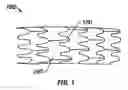 Fig. 02 - Method of making a variable surface area stent