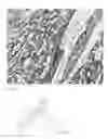 Fig. 03 - Detection, screening, and diagnosis of HPV-associated cancers
